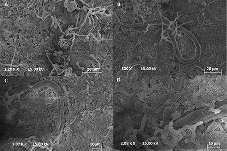 As elétron-micrografias de varredura do processo de interação do isolado Arthrobotrys cladodes var macroides com larvas infecfantes de nematoides parasitas de bovinos e dos péletes recuperados após a