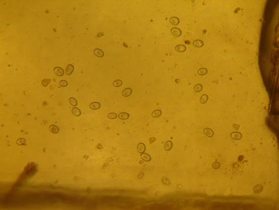 Oocistos de Eimeira spp vistos em exame de OOPG em microscópio As infecções por coccídios em animais mal nutridos podem causar mais prontamente uma perda das células das vilosidades do intestino e