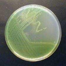 Pseudomonas aeruginosa (HARMONIZADO) TSB, 18-24h; Subculturas em Ágar Cetrimida