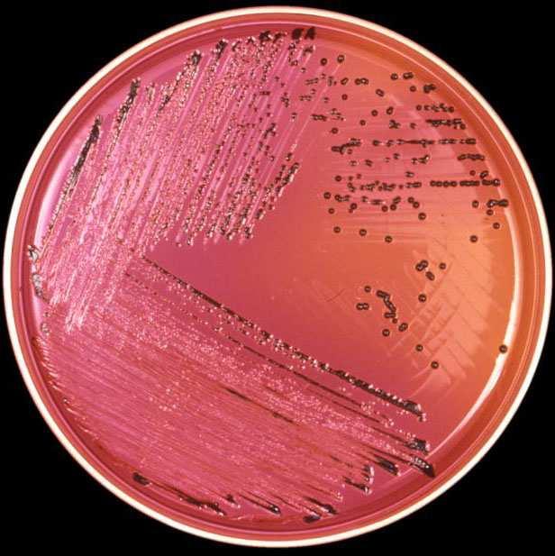 Salmonella sp (HARMONIZADO): Diluição do produto ( 10g ou 10mL) em TSB (30-35 o C, 18-24h); Transferir 0,1mL do TSB para 10mL de RVSEB (30-35 o C,