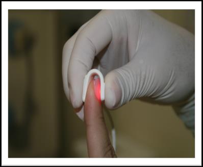 As medições também foram realizadas em dedo do paciente para determinar a saturação de oxigênio no sangue (Fig. 1A-C) em circulação.