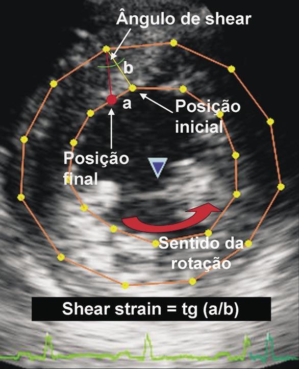 Introdução Desde as primeiras descrições anatômicas evidenciando a disposição helicoidal das fibras miocárdicas 1, até a demonstração prática de que o músculo cardíaco é formado por uma única banda