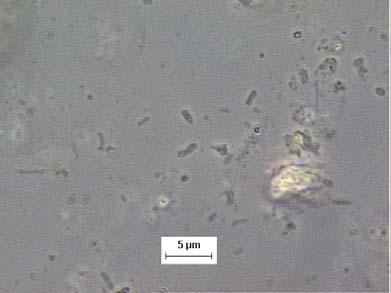 semelhantes à Methanosaeta agrupadas com fototróficas e bacilo com bordas