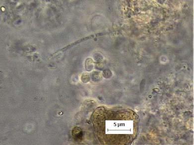 8, foram observadas distintas morfologias microbianas aderidas à espuma de