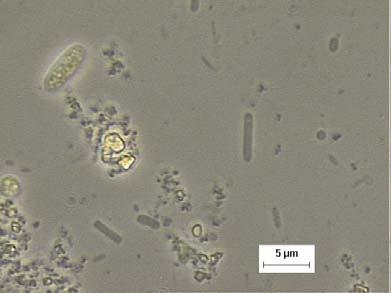 células semelhantes à Methanosaeta.