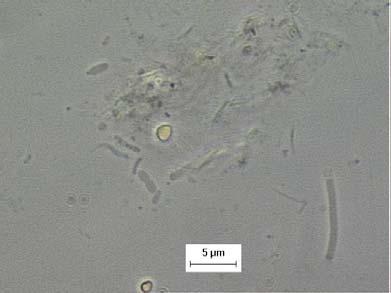 9, verifica-se que as morfologias microbianas mais observadas no lodo granular foram os