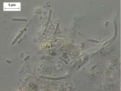+ + + + Bacilos fluorescentes - - Bactérias Bacilos com extremidades arredondadas +++ +++ Bacilos curvos + + + Bacilos