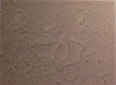 a) células semelhantes a Methanosaeta; b)