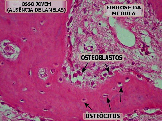 TECIDO ÓSSEO