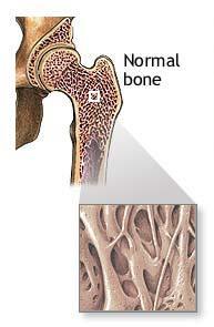 COMPONENTES DO TECIDO ÓSSEO Células: Osteoprogenitoras, Osteoblastos, Osteócitos e Osteoclastos Matriz orgânica (protéica) secretada por osteoblastos Fibras colágenas tipo I (- acidofilia GAGs