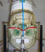 59 O crânio seco e o fantoma foram posicionados em cefalostato para obtenção de telerradiografias em norma lateral no equipamento Veraviewepocs LT (J.