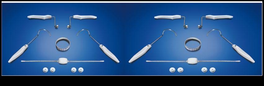 Argus T Adjustable System: Abordagem transobturatória para o tratamento da IUE Segurança e eficácia comprovadas Desenhado especificamente para a abordagem transobturatória.