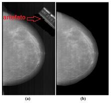 Detecção de Lesões em Mamografias Através da Assimetria foram redimensionadas, utilizando-se a biblioteca de programação para visão computacional OpenCV (BRADSKI; KAEHLER, 20