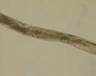 T. colubriformis (B); Região vulvar de fêmea