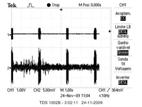 fportadora=7khz/5khz T entre impulsos ~