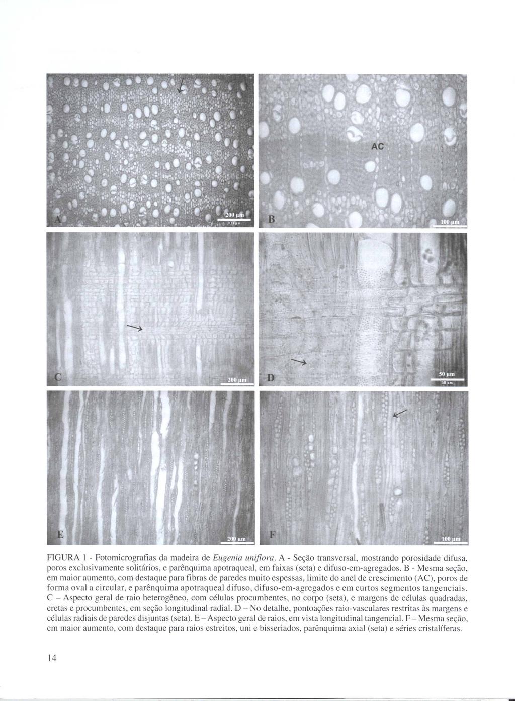 FIGURA I - Fotomicrografias da madeira de Eugenia uniflora.