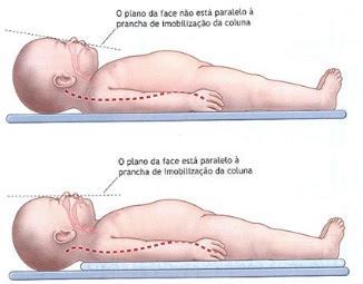 Vias aéreas Prioridade!