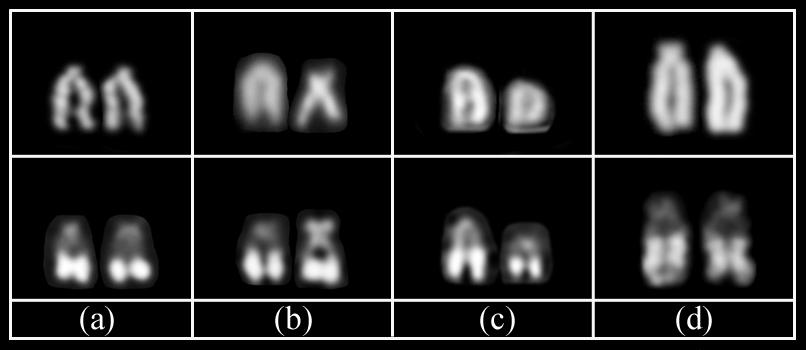 94 Resultados e Discussão Capítulo 4 Figura 7: Cromossomos subtelocêntricos/acrocêntricos evidenciados nas populações de Characidium pterostictum analisadas, após coloração com Giemsa (fileira