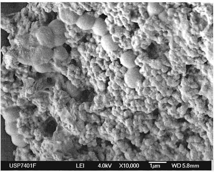 111 Figura 38: Imagem obtida através de microscopia eletrônica de varredura de