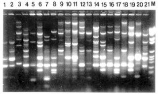 Marcadores moleculares A partir de 1970: Possibilidade de incrementar a informação oriunda do fenótipo com aquela oriunda diretamente do DNA; Marcas na seqüência de DNA próximas à região de interesse