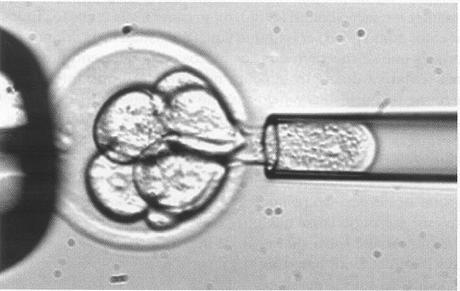 Seleção assistida por marcadores Embriologia Molecular X Seleção por marcadores Genotipagem ainda fase embrionária Só os embriões de elevado mérito genético são transferidos para fêmeas receptoras.