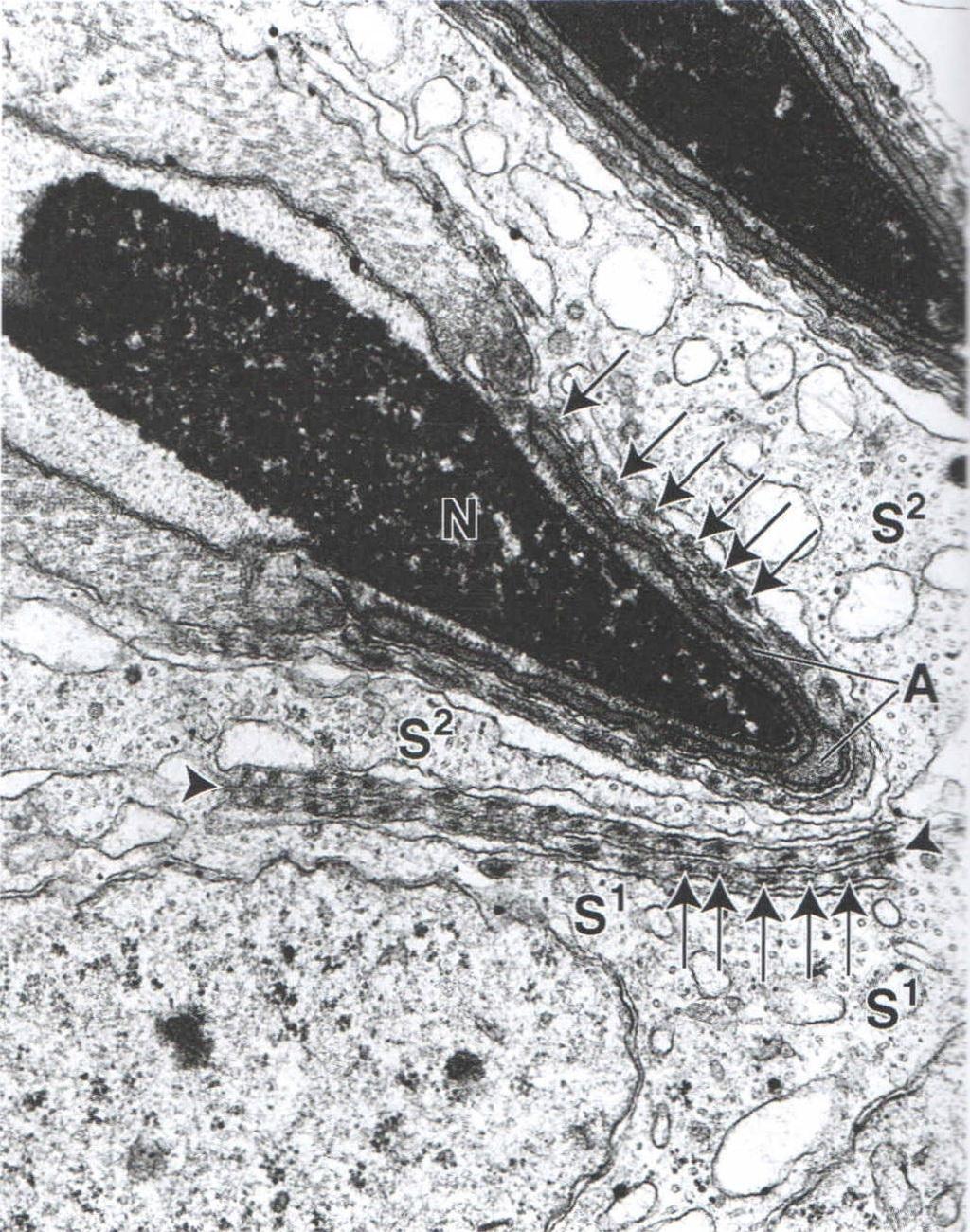 Junções celulares entre espermátide e célula Sertoli N= núcleo espermátide A= acromossomo Setas= feixes de microfilamentos Cortados transversalmente da célula de Sertoli S1= uma