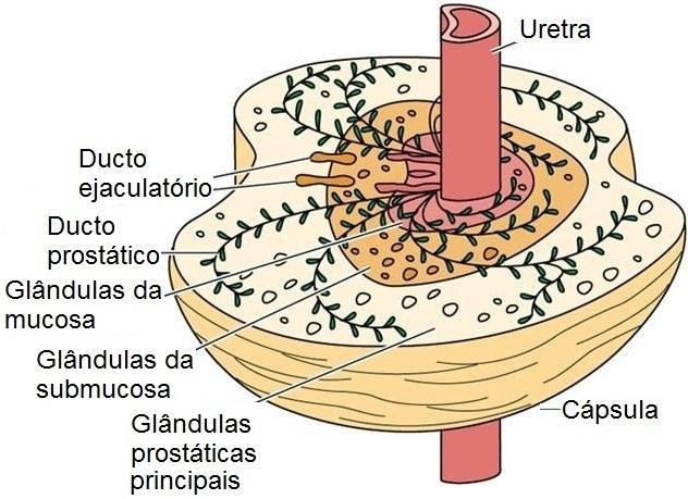 Hiperplasia