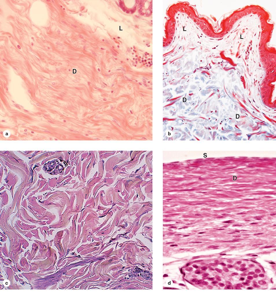 Exemplos de associação próxima entre tecidos conjuntivos frouxo e denso: a) Tecido conjuntivo de glândula b) Secção de pele, coloração com thrichrome (azul, colágeno) c) Tecido denso