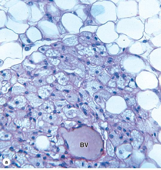 grandes 50 a 150 µm Marrom Contem várias