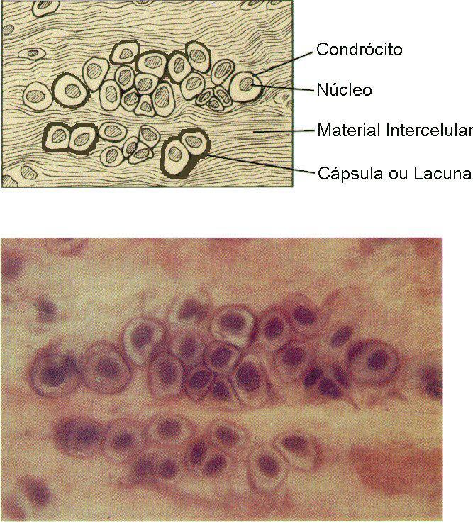 Cartilagem fibrosa Contém muitas fibras de colágeno