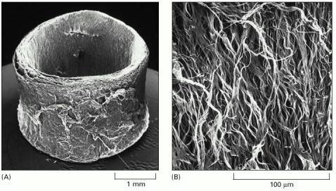 Fibras elásticas Formada pela proteína elastina que é