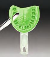 Assegurar espaço adequado entre a parede da moldeira e a dentição remanescente, particularmente nos casos de áreas