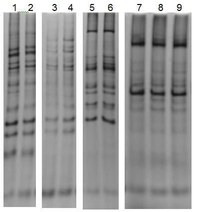 114 APÊNDICE C Comparação de isolados clínicos de um mesmo paciente, colhidos em momentos distintos, pela técnica de ERIC-PCR Figura 15 - Eletroforese em gel de poliacrilamida 8% de ERIC-PCR para