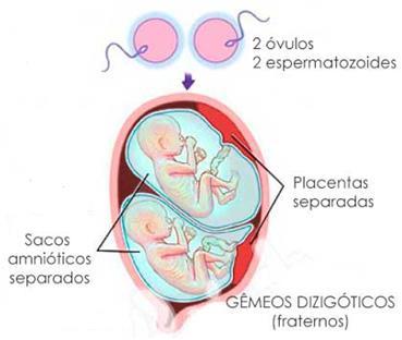 Gêmeos Bivitelinos ou Dizigóticos Gêmeos Gêmeos Univitelinos ou