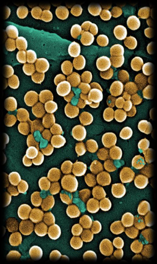 RESULTADOS Microorganismos mais frequentes: Staphylococcus spp.