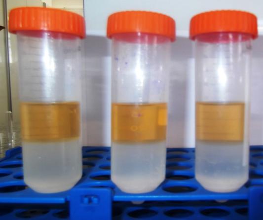 58 4478 g por 10 min. O sobrenadante foi coletado e foram realizadas sucessivas extrações com a mistura acetona:metanol, até que as células não apresentassem coloração.