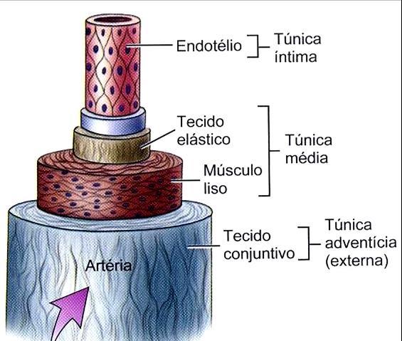 aneurismática