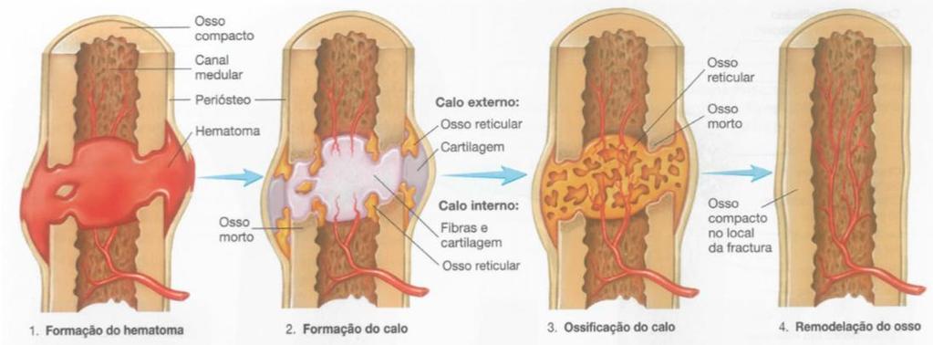 Capítulo 2 Revisão Bibliográfica processo é regulado pelas atividades dos osteoblastos e osteoclastos, até que a estrutura do osso adulto seja conseguida [14].