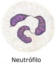 Neutrófilos MB (mieloblasto), PM