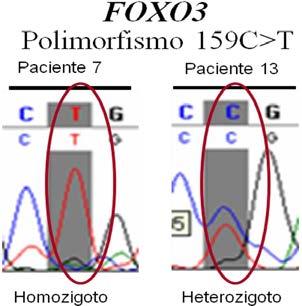 40 Figura 9. Identificação no eletroferograma das formas em homozigose e heterozigose do polimorfismo. Tabela 11. Frequência do polimorfismo encontrado nos diferentes tipos de SMD.