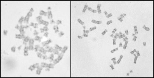 cromossomo 22. Figura 13.