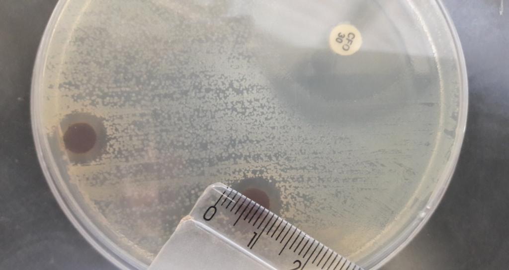 Figura 1. Halo do barbatimão 12 mm Tabela 02 Resultado do antimicrobiano de escolha para infecção por S. aureus.