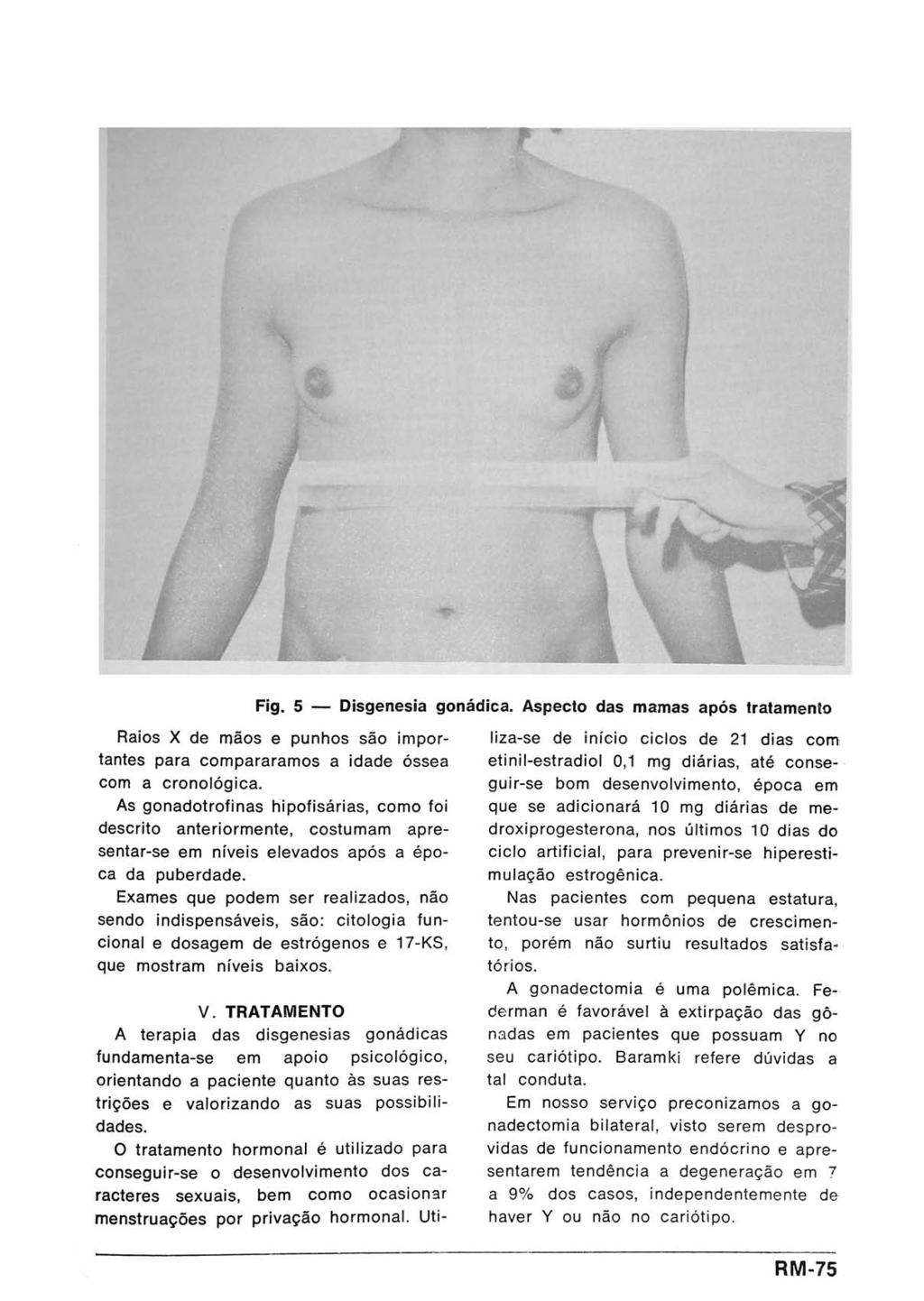 Fig. 5 Raios X de mãos e punhos são importantes para comparáramos a idade óssea com a cronológica.