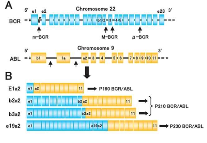 15 Em alguns casos, a LMC também pode ser resultante da quebra na região menor do gene BCR (m-bcr), levando a expressão de um transcrito que codifica a proteína p190, que em alguns casos de LMC pode
