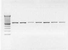 33 pelo marcador de peso molecular, que foi aplicado ao lado dos produtos da PCR, e apresenta fragmentos de DNA de tamanhos variáveis, geralmente eqüidistantes entre si.