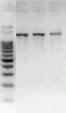 34 O programa utilizado na PCR para a amplificação considerava o início com uma desnaturação à 94ºC por 3 minutos, seguido por 40 ciclos, iniciados com uma desnaturação à 94ºC por 30 segundos,