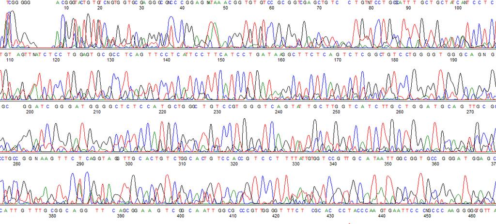 41 Gráfico 2: Análise da expressão do gene SEPT5 em 11 pacientes e 05 indivíduos controle, mostrando a significativa diferença de expressão entre os grupos.