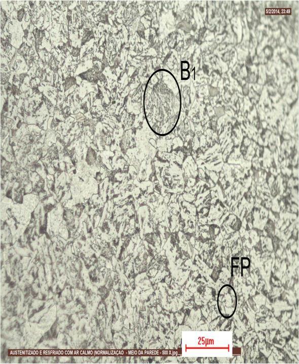 (a) MO Nital 5% - 500X (b) MO LePera - 800X FP B 1 CAR.