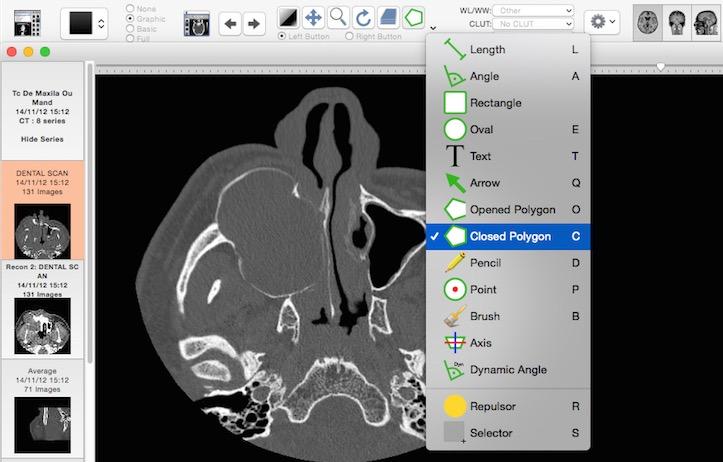 Osirix.