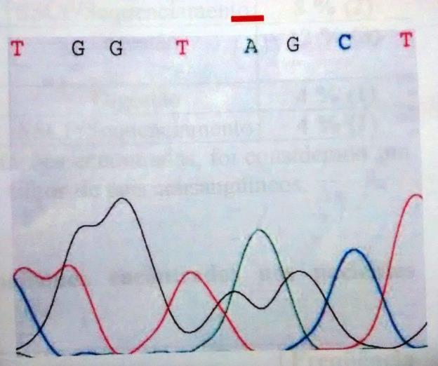 sequenciamento direto do gene da PAH: A) Identificação do